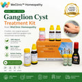 Ganglion Cyst Treatment Kit By WeClinic Homeopathy